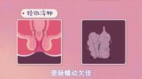 产后痔疮好尴尬?快学急招预防它 55