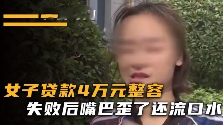 品人生百味第二季 女子贷款四万元整容，失败后嘴巴歪了还流口水，经理：你自愿的！