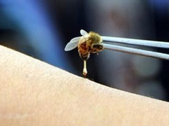 经典传奇 疯狂的怪事 探秘活蜂蛰刺疗法
