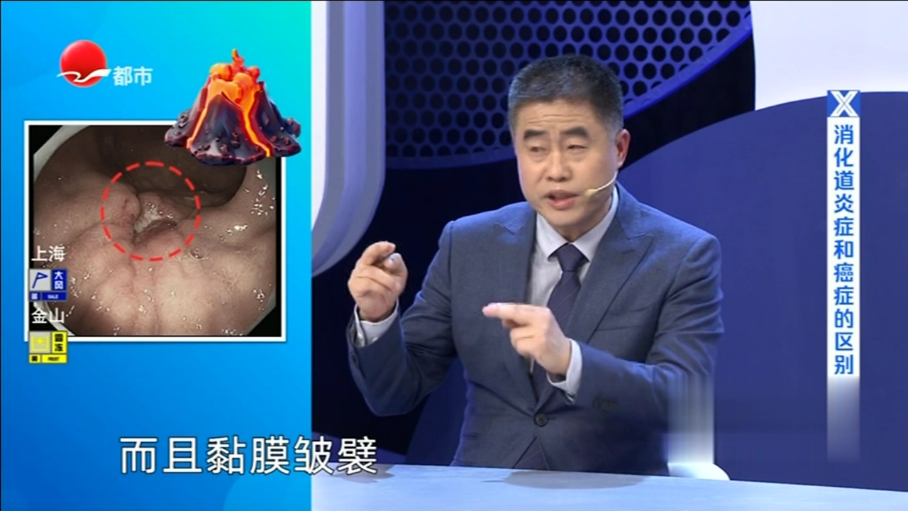 X诊所. 胃肠道出现哪些情况需引起重视