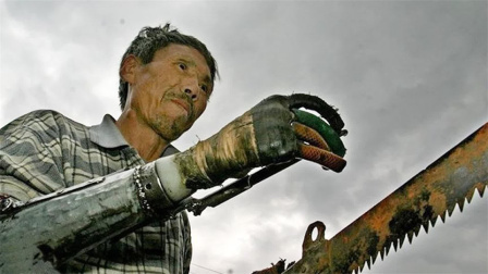 断臂大叔花费30年，发明机械铁手，行动灵活自如，已造福千余人