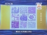 健康之路 《健康之路》 20131210 癌症早知道（一）
