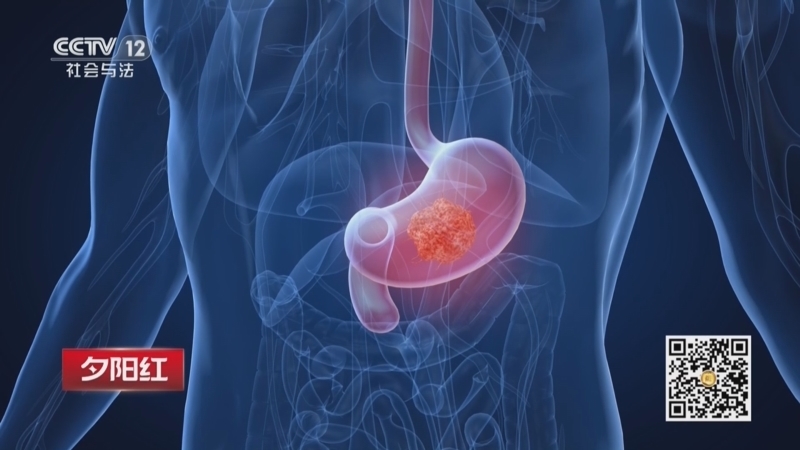 《夕阳红》 20260408 胃，你好吗？（1）