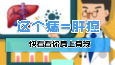 医生看一眼这个“痣”，就说是肝癌信号？快看看自己身上有没有