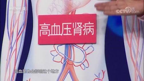 职场健康课 《职场健康课》 20190319 难治的高血压