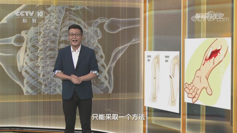 解码科技史 《解码科技史》 20201018 修复生命的支撑