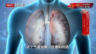 养生堂_20260306_警惕“咳不停”的变癌风险