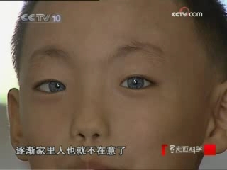 走近科学 “夜视”男孩