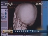 消费主张 《消费主张》 20140721 孩子被锐器伤害 你该怎么办？