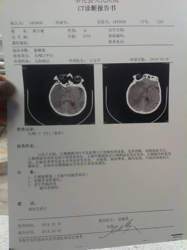 头部CT报告图片