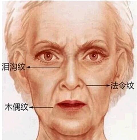 有了第二条线(鼻唇沟,法令纹),证明你的脸部肌肤开始衰老