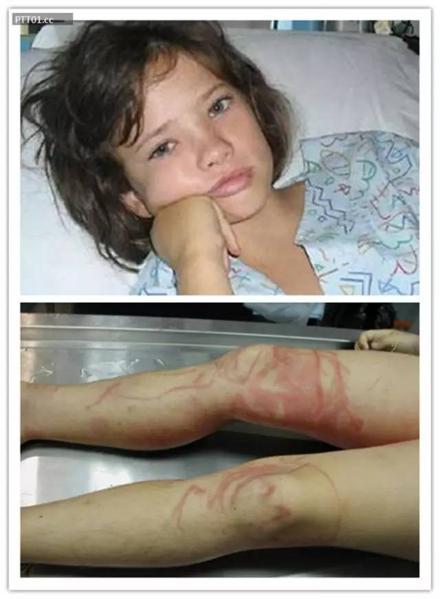 no,1 澳洲箱形水母