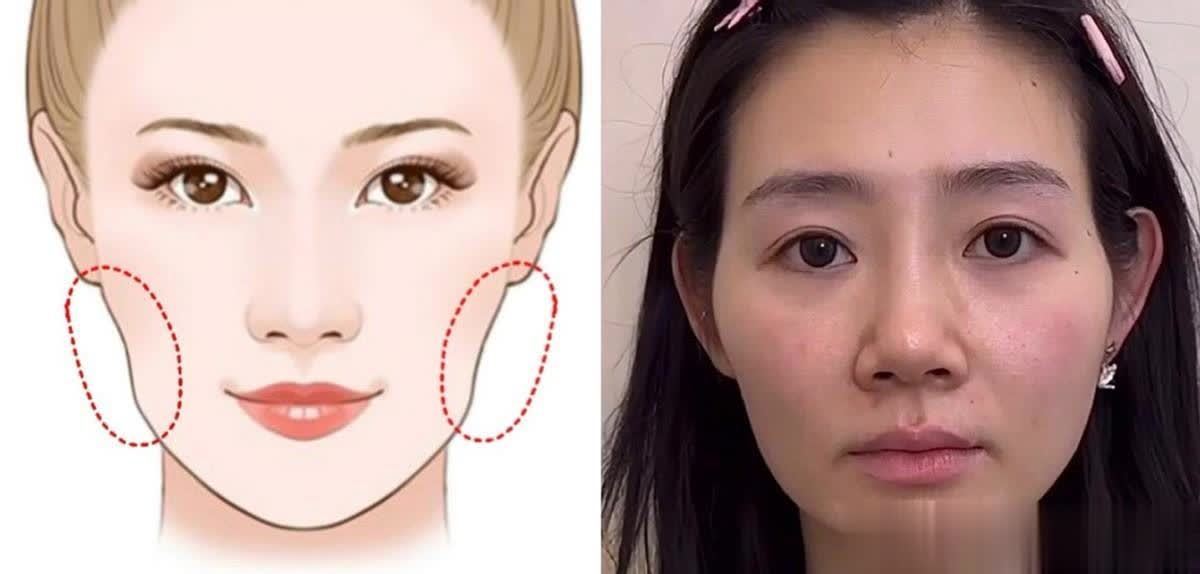 中年发腮最毁颜值?脸部凹陷比发腮可怕多了 - 360娱乐,你开心就好