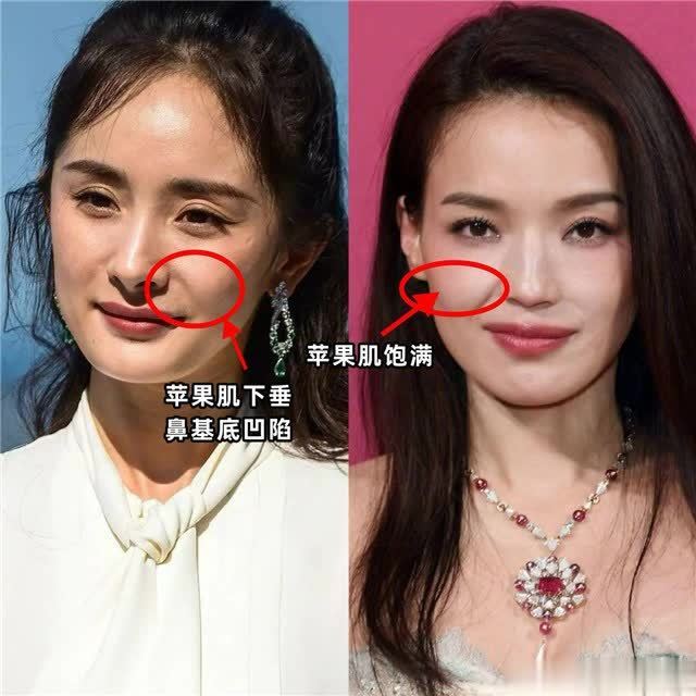 揭秘:方脸胜过瓜子脸的4大魅力,无论配帽或眼镜都超上镜! - 360娱乐,你开心就好