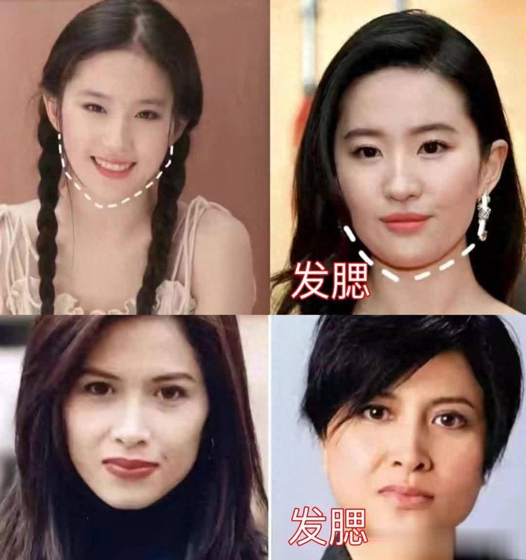 中年发腮最毁颜值?脸部凹陷比发腮可怕多了 - 360娱乐,你开心就好